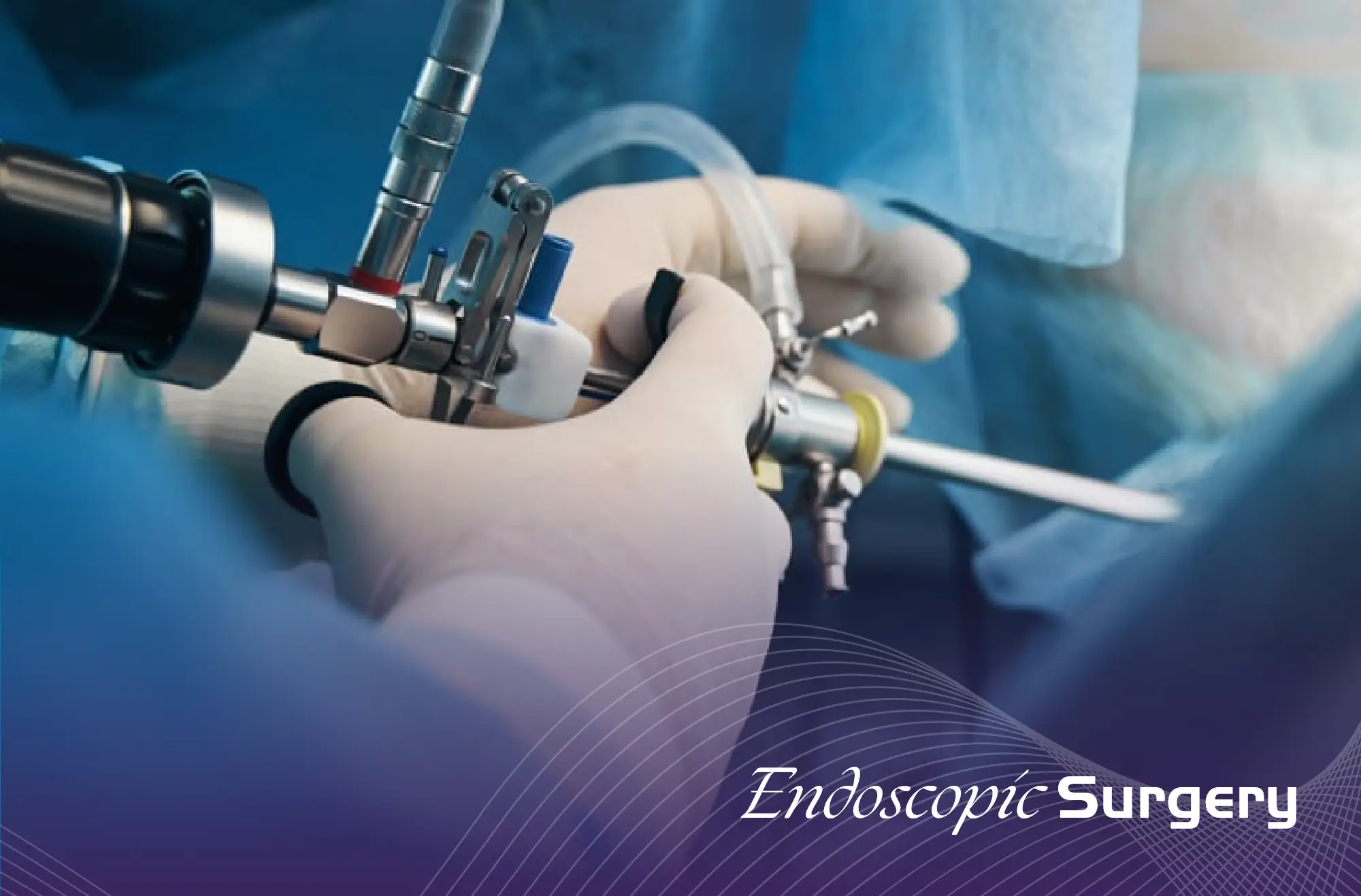 Endoscopic Surgery image