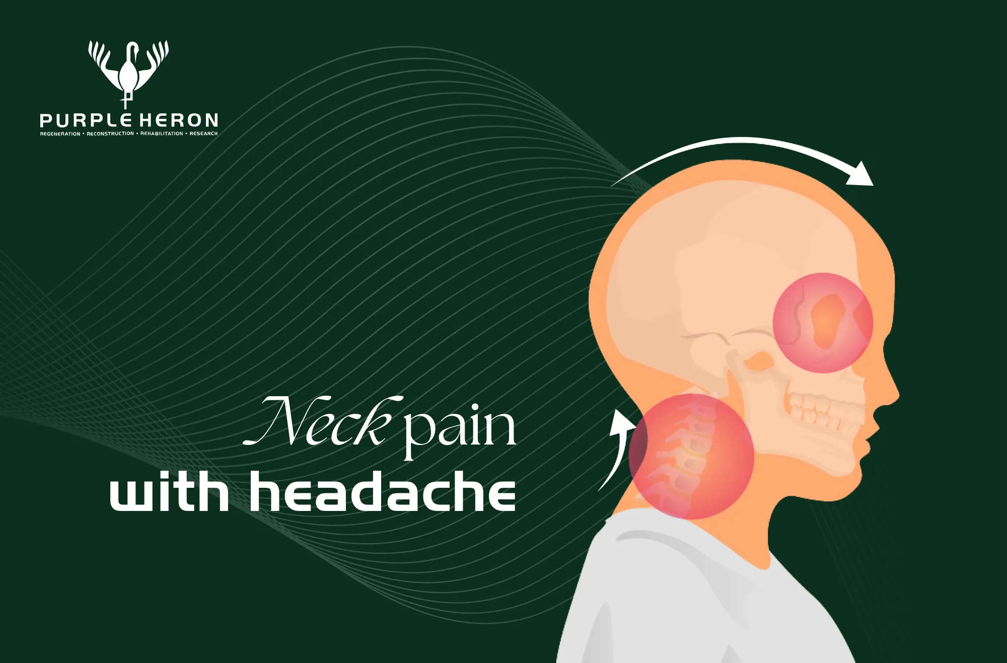 Neck pain with headache image