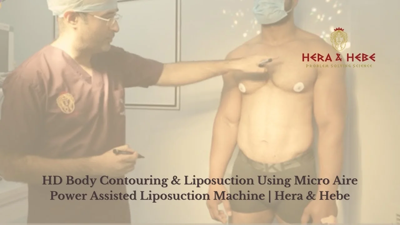 liposuction Surgery in jaipur