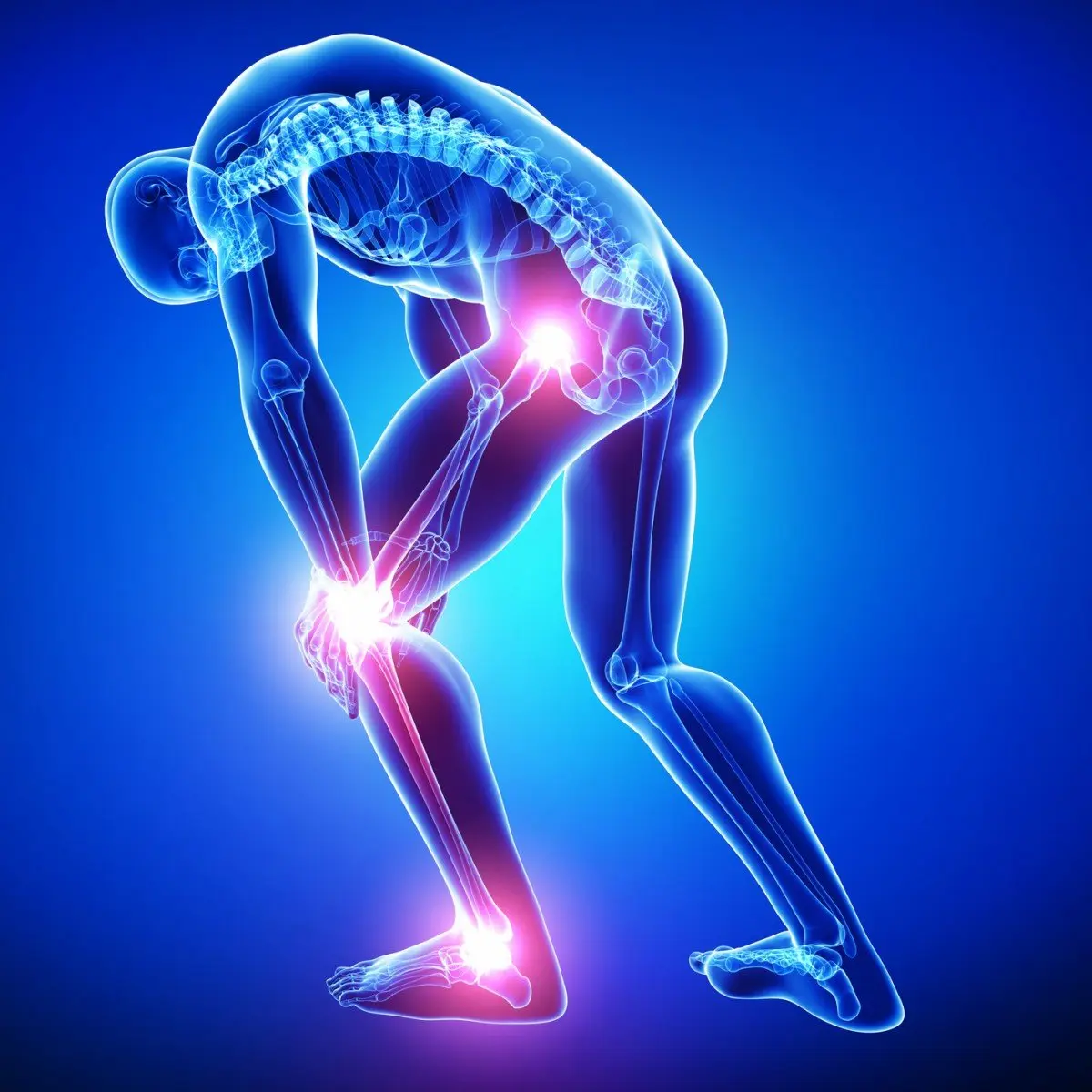 knee-pain