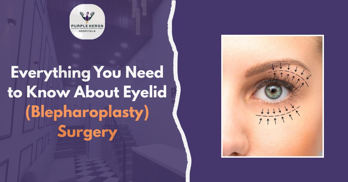 Blepharoplasty