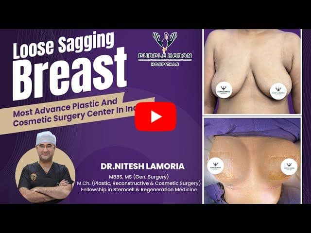 Loose Sagging Breast