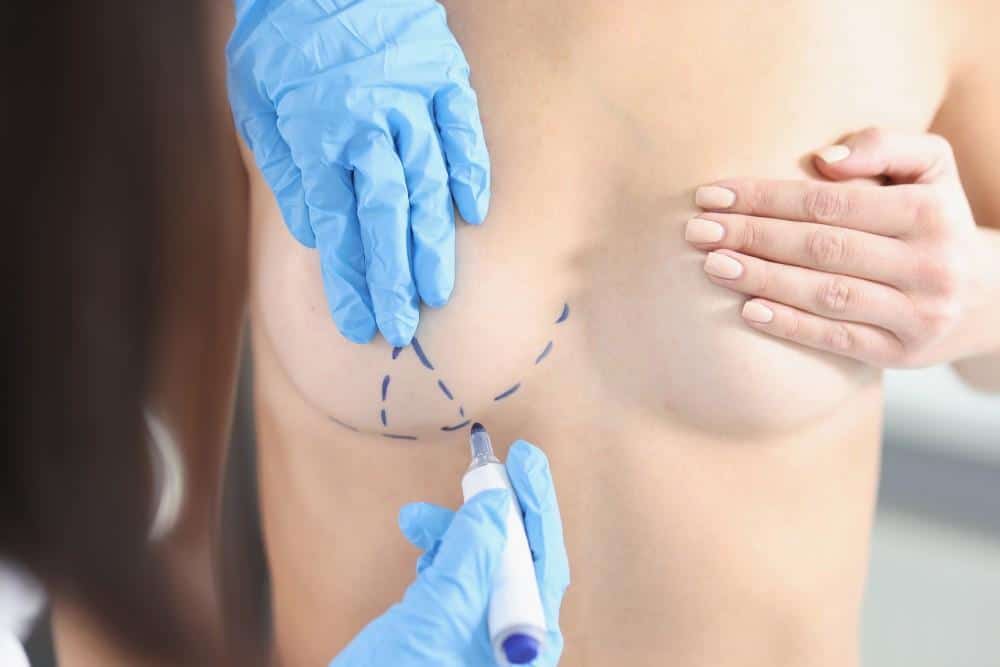 breast reduction Jaipur