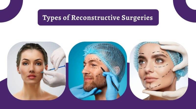 What Type of Reconstructive Surgery Do You Need? A Detailed Overview