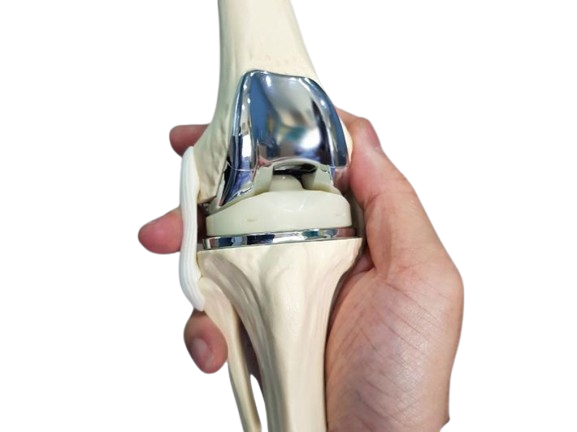 Joint Replacement Surgery