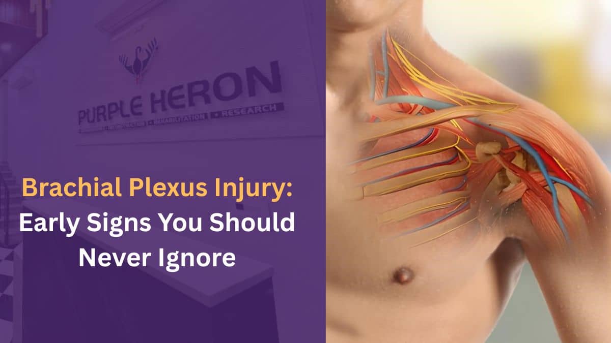 Brachial Plexus Injury: Early Signs You Should Never Ignore