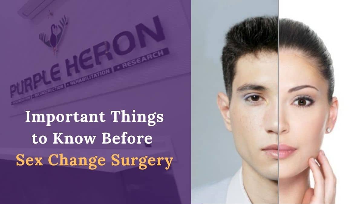 Important Things to Know Before Sex Change Surgery