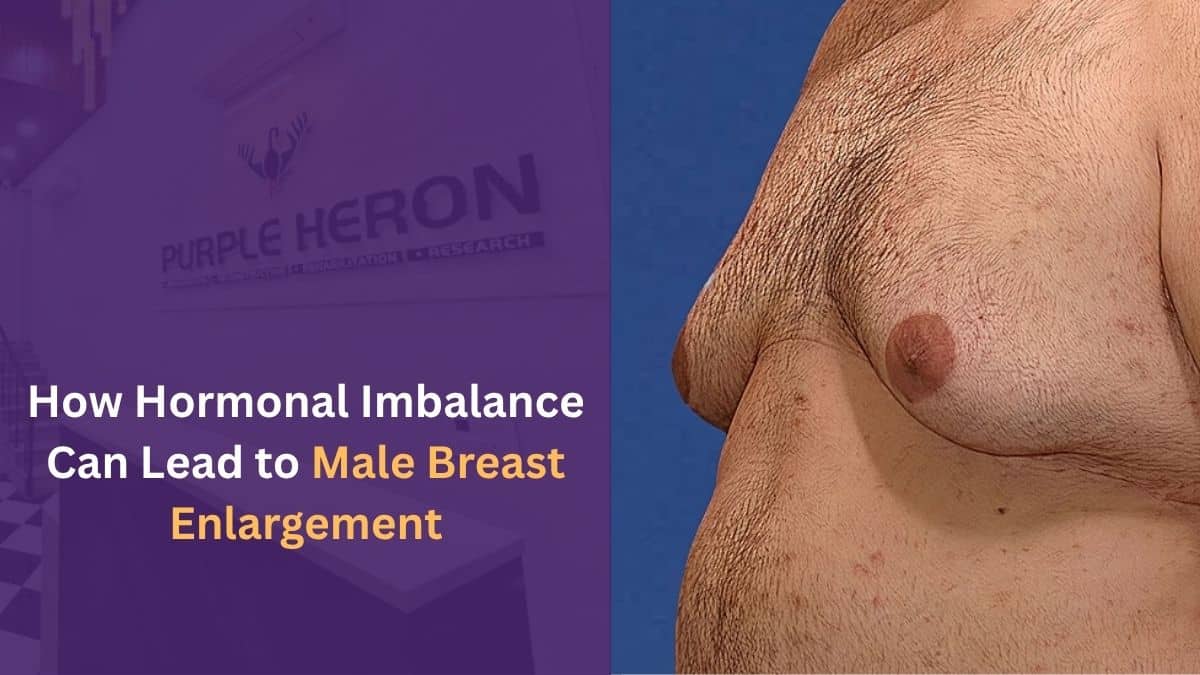 How Hormonal Imbalance Can Lead to Male Breast Enlargement