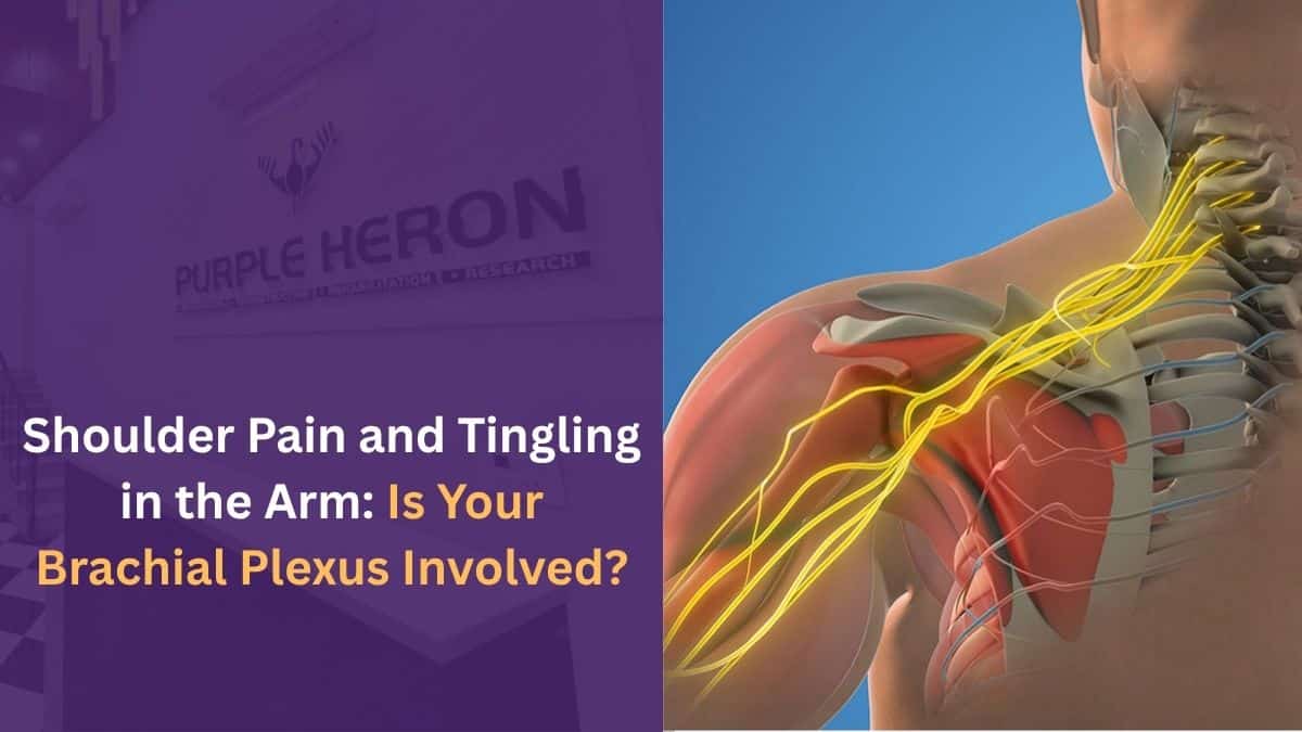 Shoulder Pain and Tingling in the Arm: Is Your Brachial Plexus Involved?