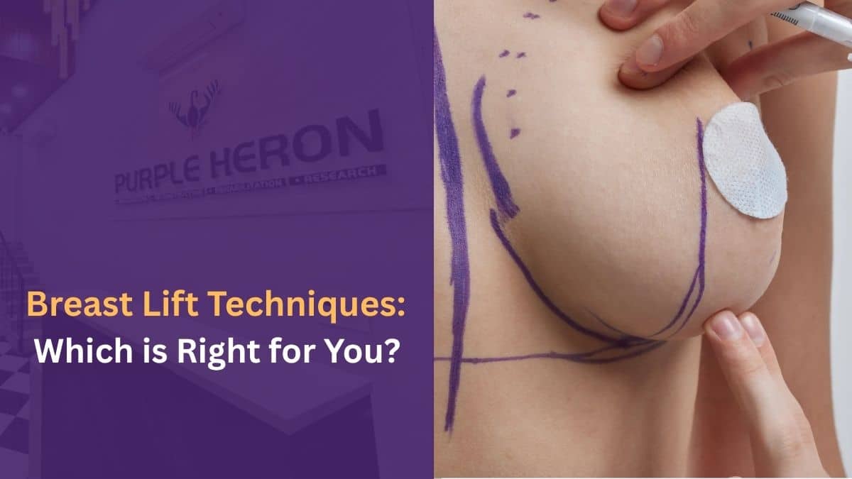 Breast Lift Techniques: Which Procedure Is Right for You?