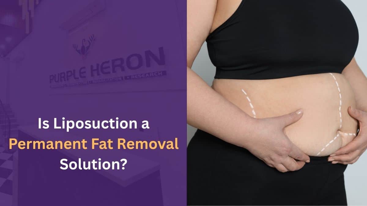 Is Liposuction a Permanent Fat Removal Solution?