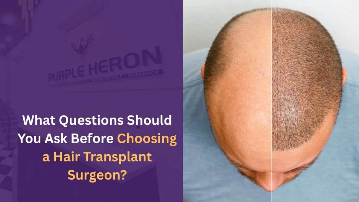 What Questions Should You Ask Before Choosing a Hair Transplant Surgeon?